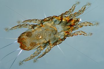 Female parasite of curlew under microscope