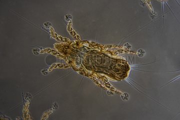 Male parasite of curlew under microscope