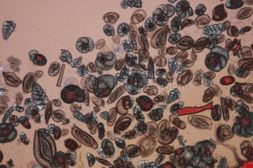 Microscopic view of Foraminifera