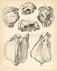 Cranium and sternum of the extinct Rodrigues solitaire  Pezophaps solitaria.