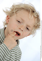 DOULEUR DENT ENFANT PAINFUL TOOTH IN A CHILD