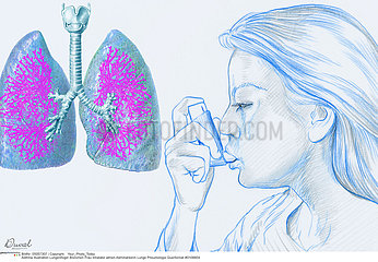 ASTHME FEMME DESSIN ASTHMA  WOMAN DRAW