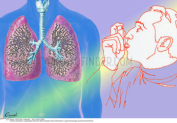 ASTHME 3EME AGE DESSIN ASTHMA  ELDERLY PERSON DRAW