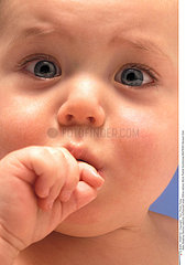 DOULEUR DENT NOURRISSON PAINFUL TOOTH IN AN INFANT