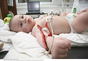 ECG ENFANT!!ECG OF A CHILD