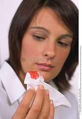 EPISTAXIS FEMME WOMAN WITH NOSEBLEED
