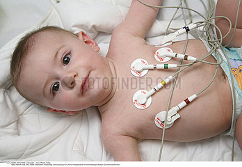 ECG ENFANT!!ECG OF A CHILD