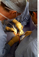 IMPLANT DENT CHIRURGIE!!IMPLANT TOOTH SURGERY