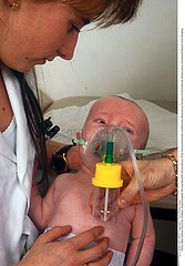 RESPIRATION THERAPEUTIQUE NOURR.!!BREATHING  TREAT. OF AN INFANT