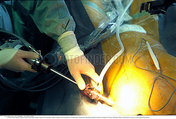 CHIRURGIE ROBOT!ROBOT-ASSISTED SURGERY
