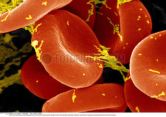 HEMATIE MEB!!RED BLOOD CELL  MEB