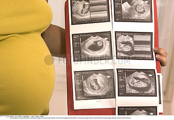 FEMME ENCEINTE ECHOGRAPHIE!!PREGNANT WOMAN  ULTRASONOGRAPHY