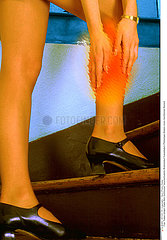 DOULEUR JAMBE FEMME!!LEG PAIN IN A WOMAN