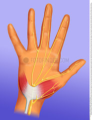 CANAL CARPIEN SYNDROME DESSIN!!CARPAL TUNNEL SYNDROME  DRAWING