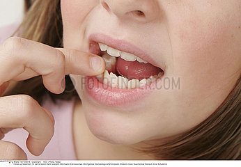 DOULEUR DENT ENFANT!!PAINFUL TOOTH IN A CHILD
