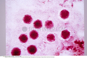 HEPATITE A VIRUS!!HEPATITIS A VIRUS