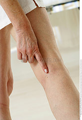 JAMBE SEMIOLOGIE 3EME AGE!!LEG  SYMPTOMATOLOGY IN ELDERLY.P