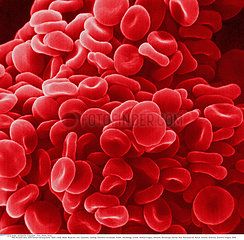 HEMATIE MEB!RED BLOOD CELL  SEM