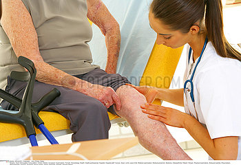 JAMBE SEMIOLOGIE 3EME AGE!LEG  SYMPTOMATOLOGY IN ELDERLY.P