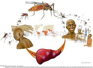 PALUDISME DESSIN!MALARIA  ILLUSTRATION