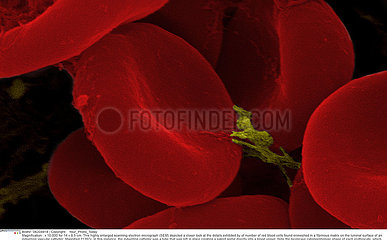 RED BLOOD CELL  SEM