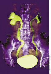 URINARY SYSTEM  X-RAY FINDING