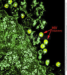 AIDS VIRUS INFECTION  TEM