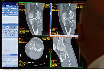 Serie Reportage_109 Knie  CT CT SCANNER EXAMINATION
