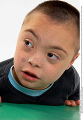 CHILD  DOWN'S SYNDROME