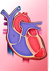 HEART ANEURYSM