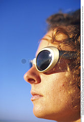 PHOTOPHOBIA IN A WOMAN
