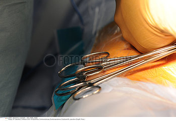 SURGICAL EQUIPMENT