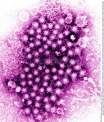 HEPATITIS VIRUS  TEM