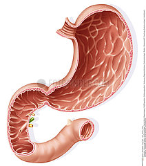 STOMACH  DRAWING