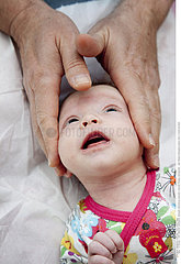 OSTEOPATHIC TREATMENT OF INFANT