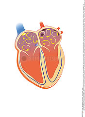 HEART FIBRILLATION  ILLUSTRATION