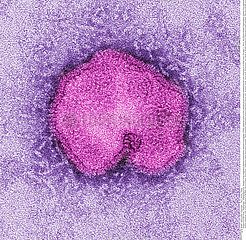 INFLUENZA A H7N9 VIRUS