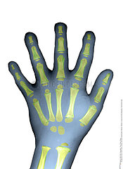 CHILD HAND  X-RAY