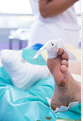 Reportage_184 Endokrinologie / DIABETIC FOOT