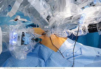 Roboter unterst?tzte Operation /ROBOT-ASSISTED SURGERY
