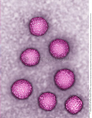 HEPATITIS E VIRUS