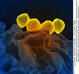 Streptococcus pyogenese Bacteria