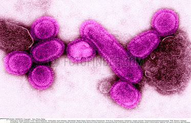 SPANISH FLU VIRUS Imagerie