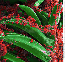 Yersinia pestis Bacteria Imagerie