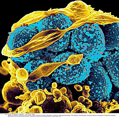 Methicillin-Resistant Staphylococcus aureus (MRSA) Bacteria Imagerie
