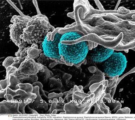 Hospital-Associated Methicillin-resistant Staphylococcus aureus (MRSA) Bacteria