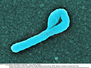 Ebola virus Imagerie