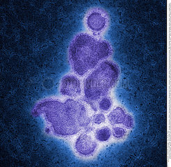 INFLUENZA A H7N9 VIRUS Imagerie