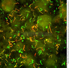 Lyme Disease Bacteria Imagerie