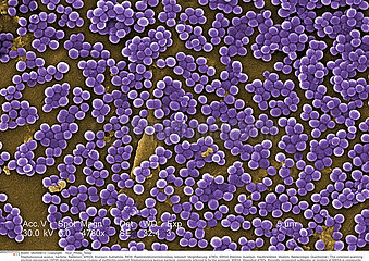 Methicillin-resistant Staphylococcus aureus bacteria Imagerie